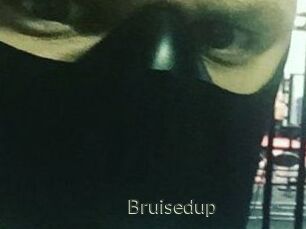 Bruisedup