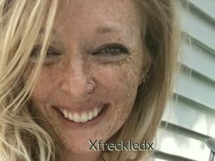 Xfreckledx